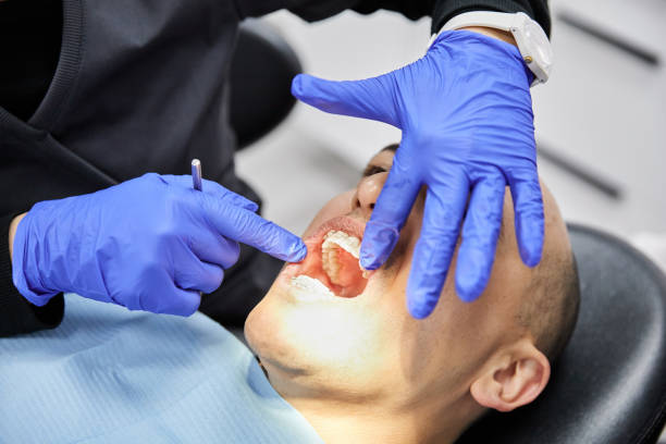 Best Emergency Treatment for Dental Infections or Abscesses in San Francisco, CA
