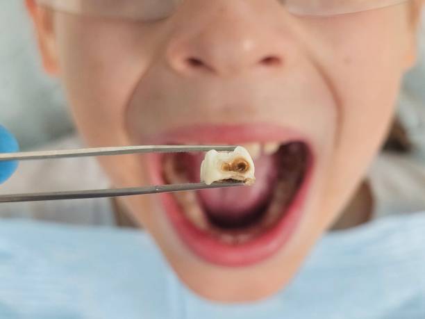 Best Emergency Denture Repair in San Francisco, CA